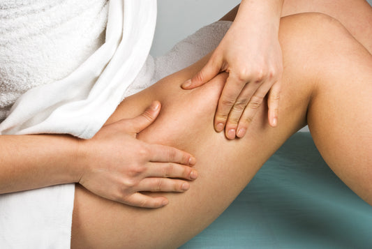 cellulite